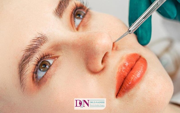 تحلیل هزینه جراحی بینی