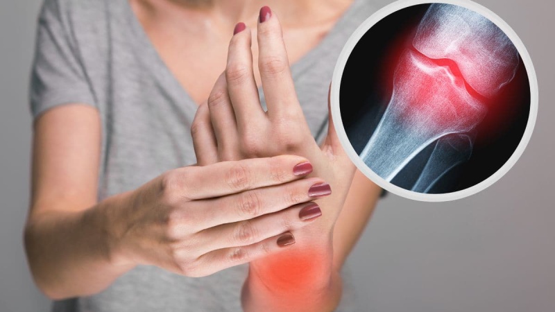 تفاوت التهاب آرتروز با روماتیسم مفصلی