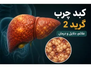 معرفی کلی درمان کبد چرب با روش های گیاهی و خانگی