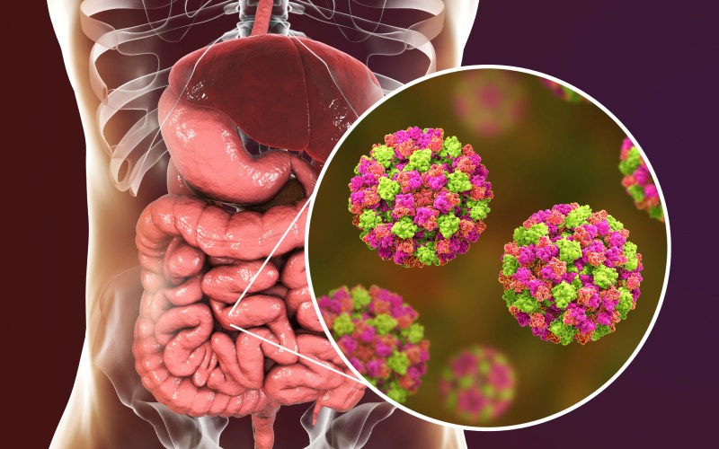 نورویروس چیست و چگونه می‌توان از آن پیشگیری کرد؟
