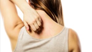 علت خارش پوست موهای کرکی چگونه پیام هشدار را به مغز می فرستند؟