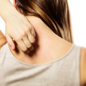 علت خارش پوست موهای کرکی چگونه پیام هشدار را به مغز می فرستند؟