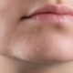 هوای خشک خانه چه اثری بر پوست