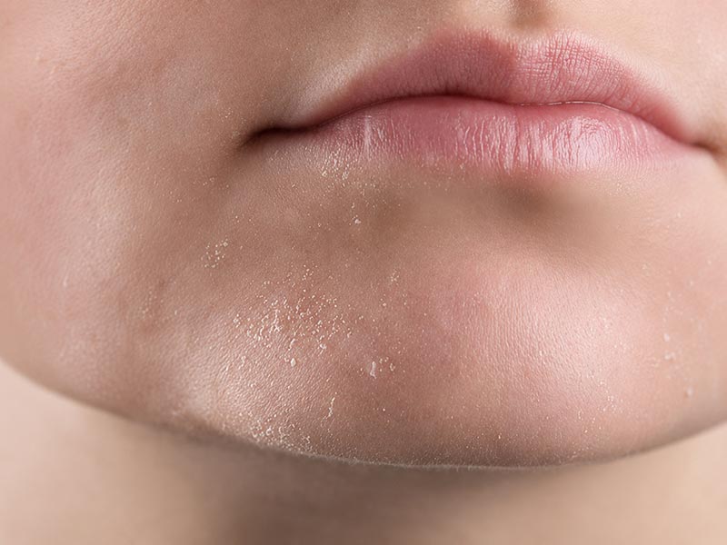 هوای خشک خانه چه اثری بر پوست